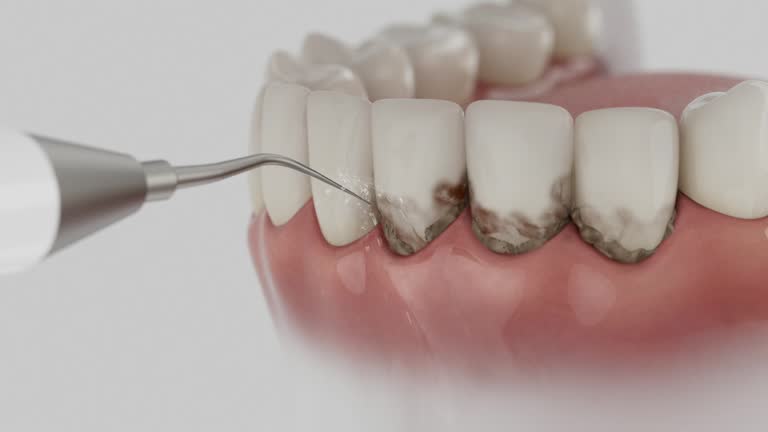 Reliable Dental contractor in Shamrock, TX by Smile Center Dentistry